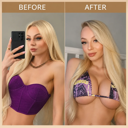 🔥🔥Tiworld® 💃Targeted Breast Enhancement Advanced Nano Microneedle Patch✨