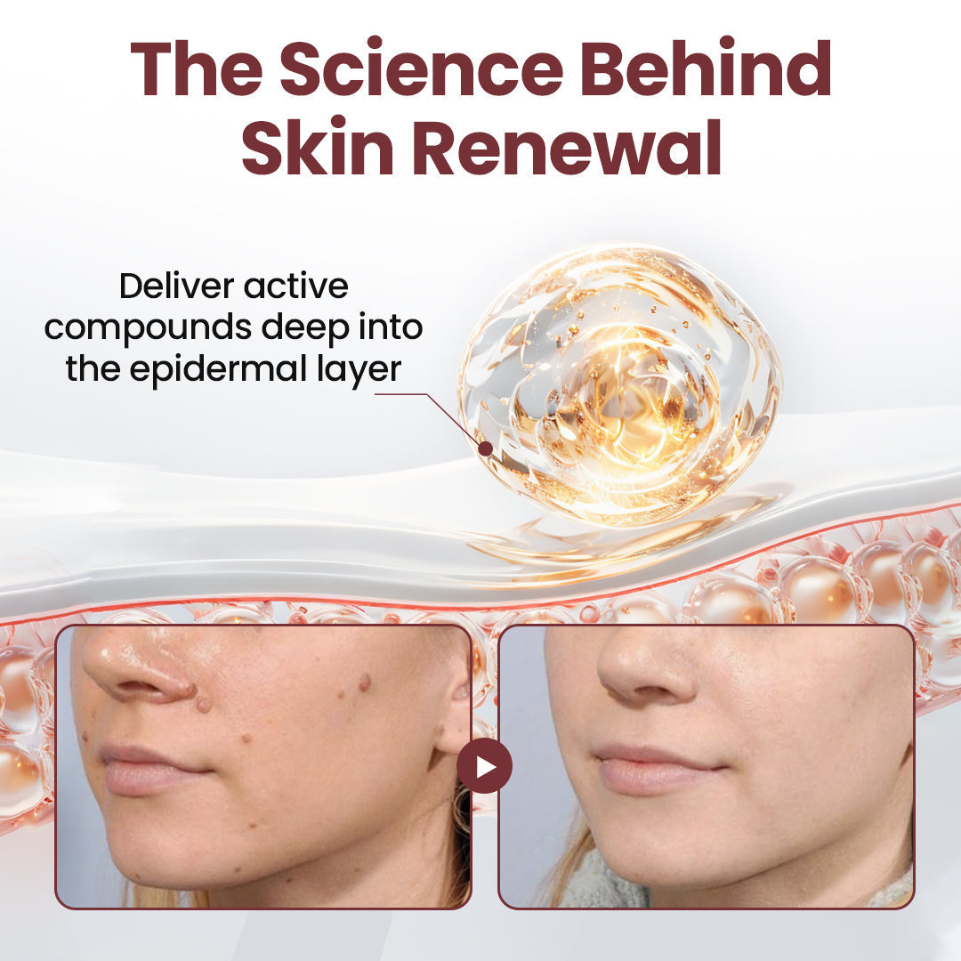 SEAGRIL®KeraErase Dual-Action Renewal Cream