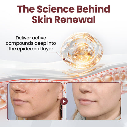 SEAGRIL®KeraErase Dual-Action Renewal Cream