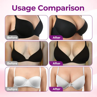 🔥🔥Tiworld® 💃Targeted Breast Enhancement Advanced Nano Microneedle Patch✨