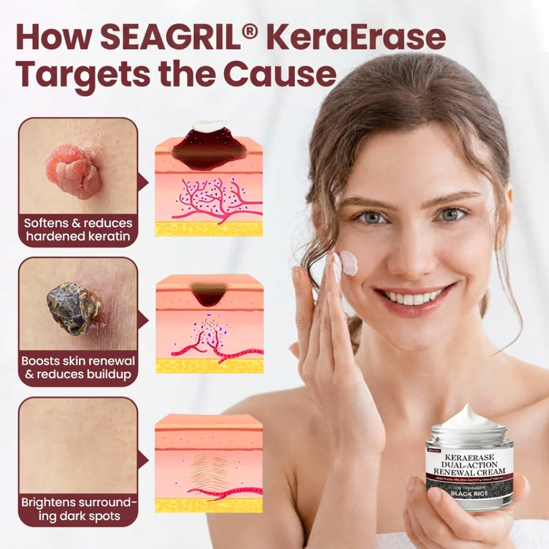 SEAGRIL®KeraErase Dual-Action Renewal Cream