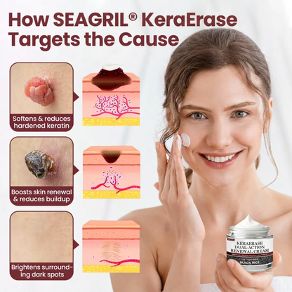 SEAGRIL®KeraErase Dual-Action Renewal Cream